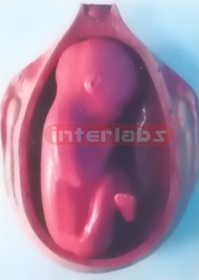 UTERUS WITH EMBRYO (9 MONTH)